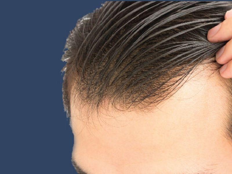 Cách làm tóc phồng nam hiệu quả