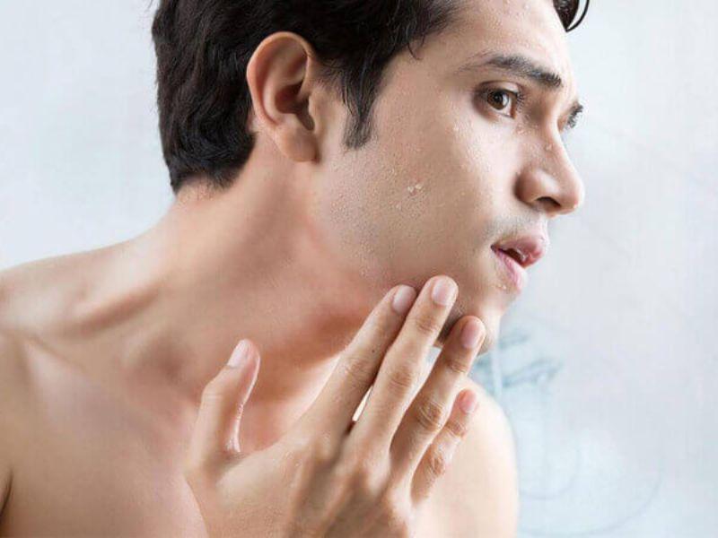 Râu vẫn mọc lại sau khi nhổ