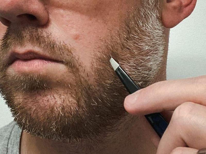 Lực tác động mạnh khi nhổ râu có thể khiến da bị tổn thương
