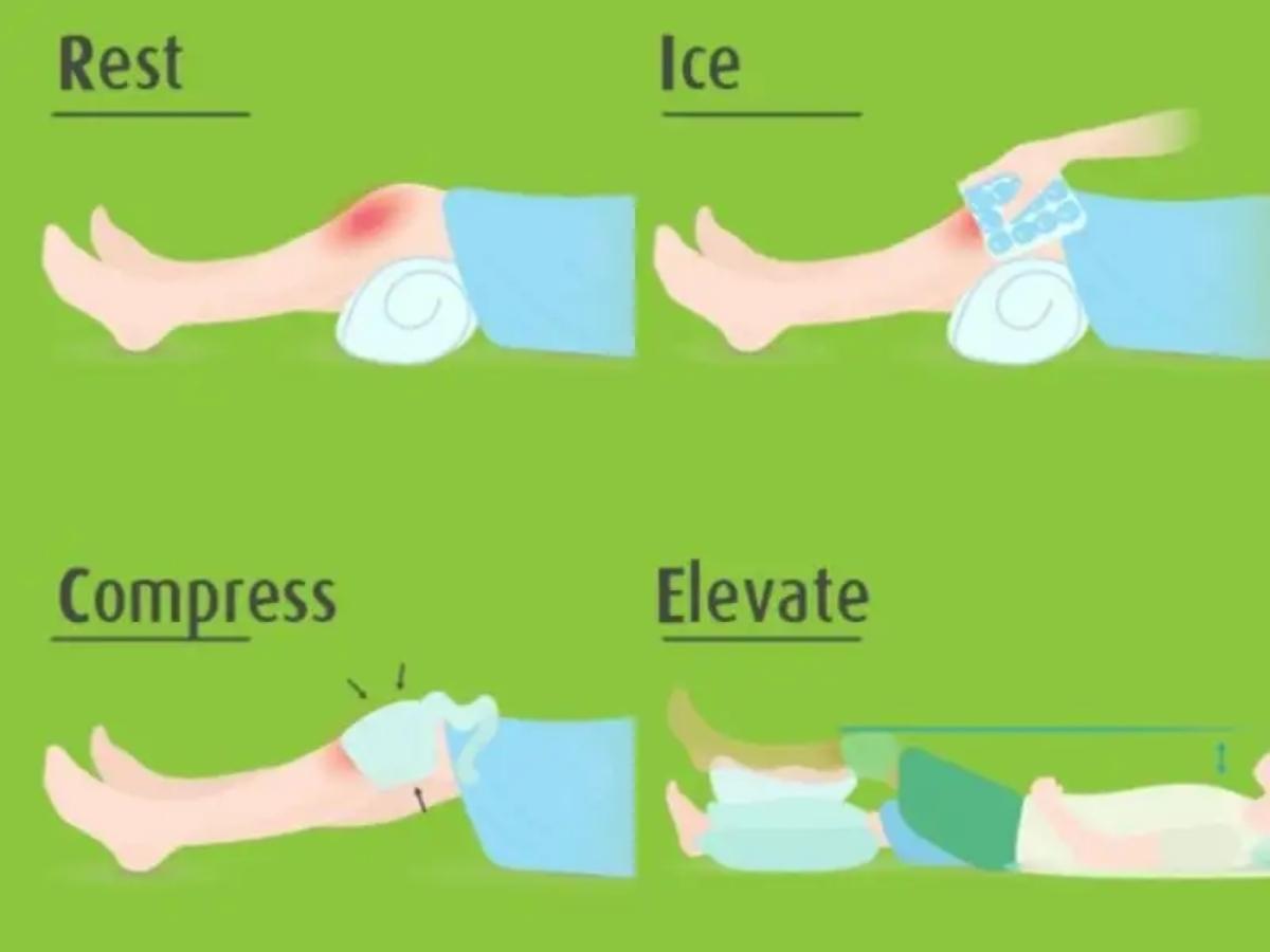 RICE là phương pháp điều trị chấn thương cơ bản