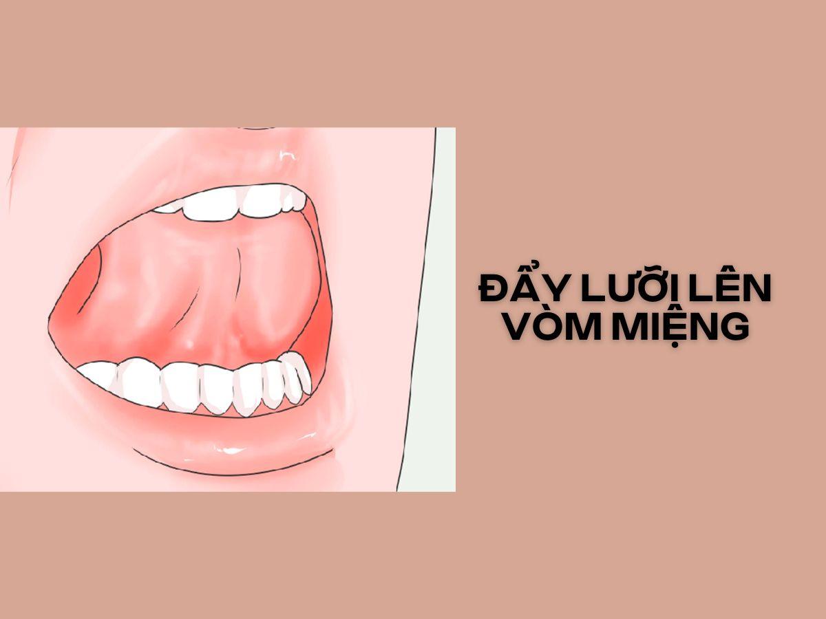 Đẩy lưỡi lên vòm miệng