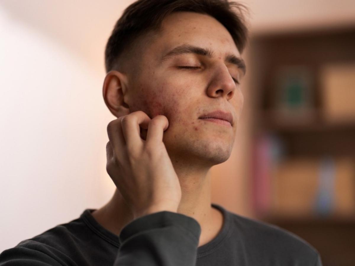 Các thói quen xấu ảnh hưởng đến da mặt nam giới (thức khuya, stress, ăn uống không lành mạnh, skincare sai cách, ánh sáng xanh)