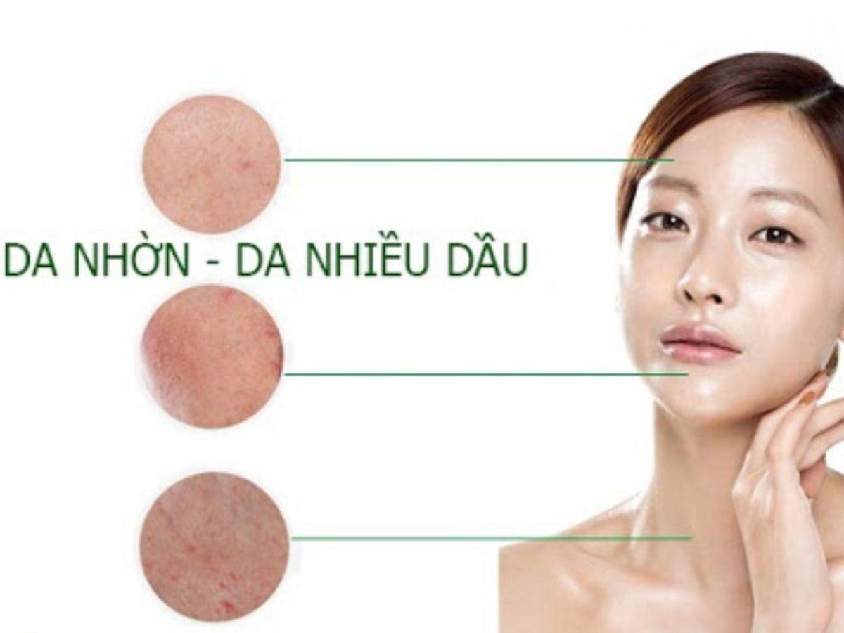 Nguyên nhân chính của tình trạng này là tuyến bã nhờn hoạt động quá mức