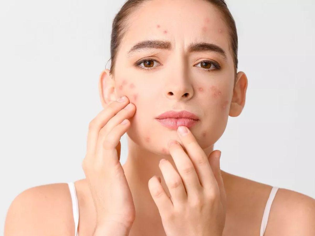 Các thành phần tiềm ẩn nguy cơ gây kích ứng