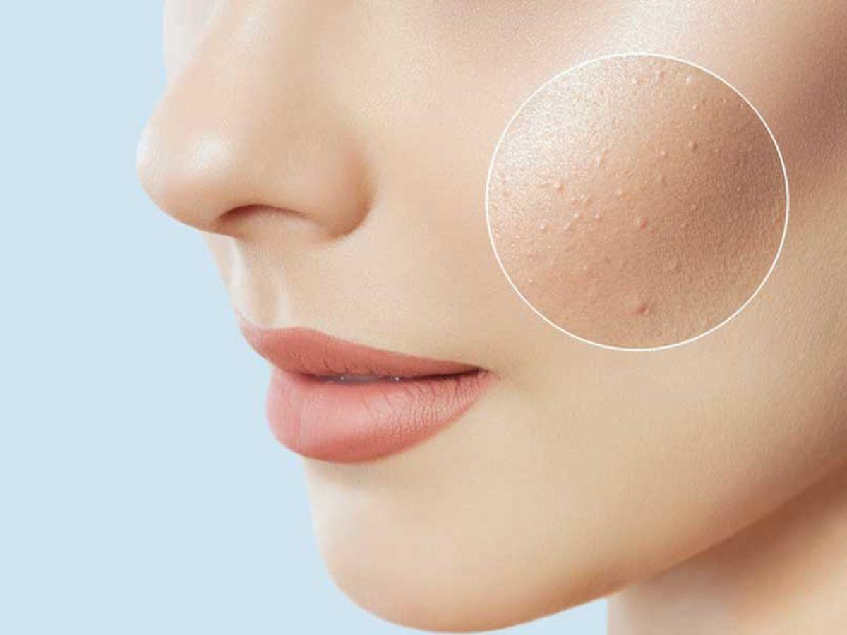 Sự có mặt của các thành phần trị mụn, làm dịu này sẽ là điểm cộng lớn cho sữa rửa mặt