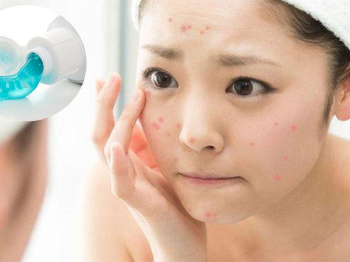 Bên cạnh những thành phần tốt, bạn cũng cần nhận diện những thành phần có khả năng gây hại cho làn da hỗn hợp