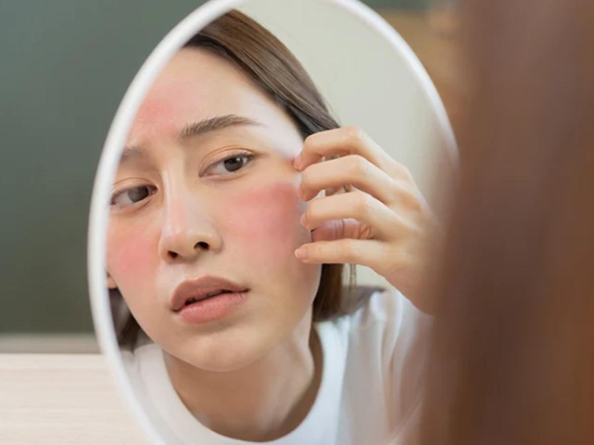Làn da nhạy cảm cần được bảo vệ cẩn thận