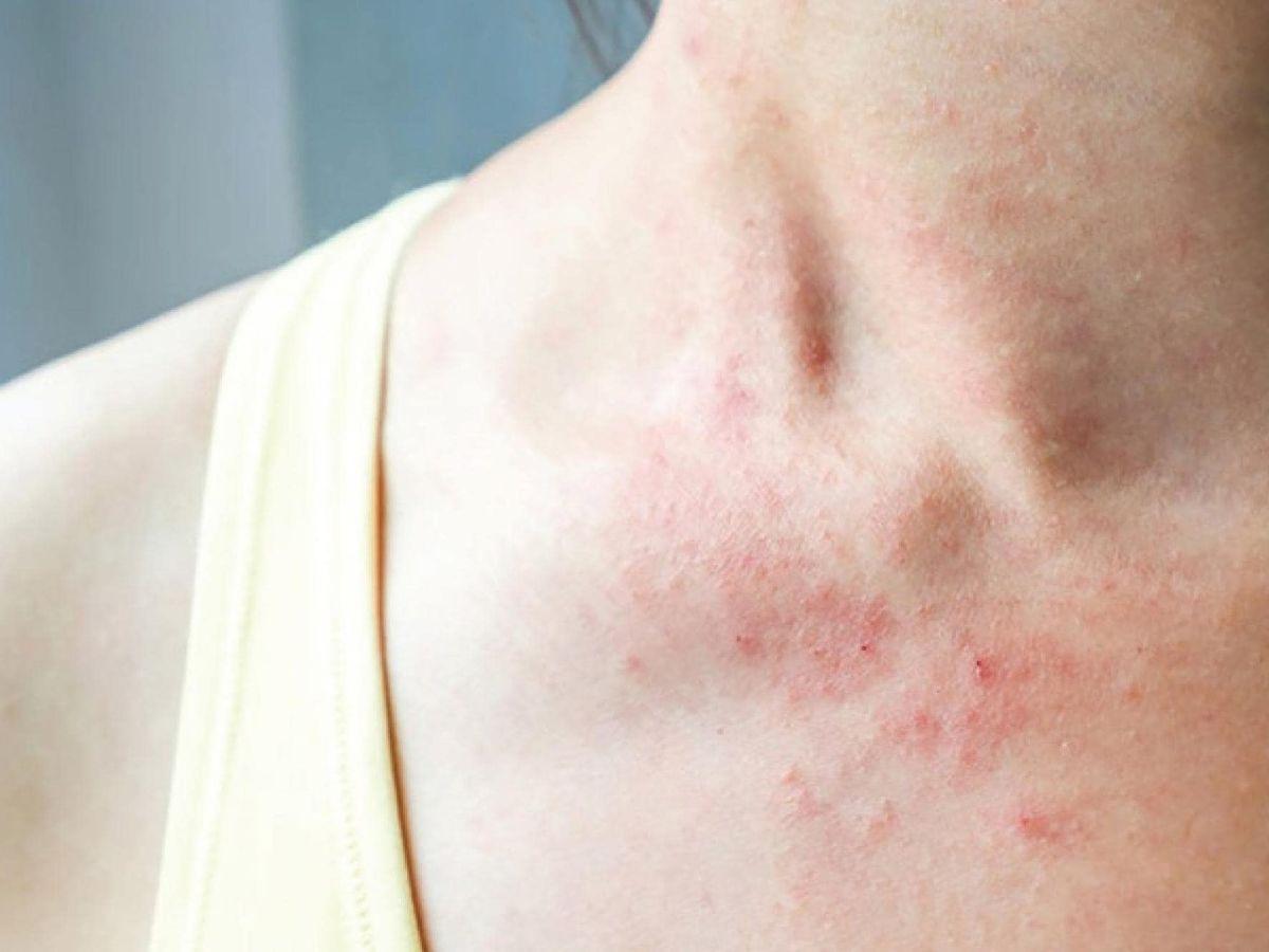 Nhược điểm của trang sức vàng trắng