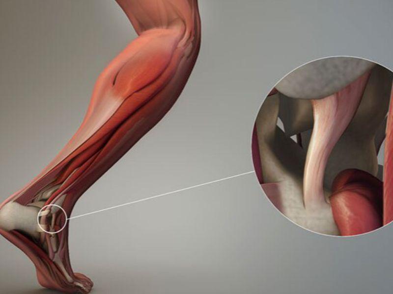 dau-dau-goi-khi-chay-bo-la-gi-4249