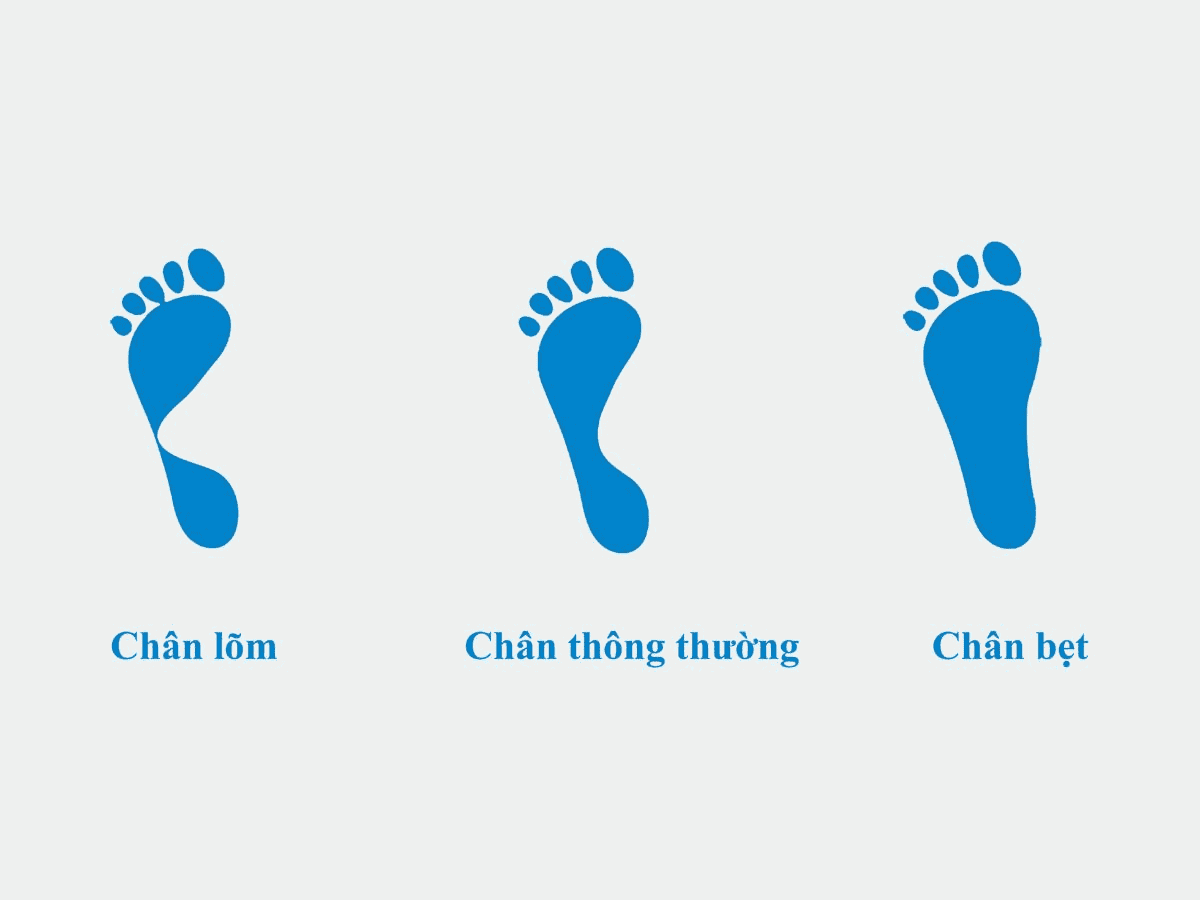 Xác định dáng bàn chân