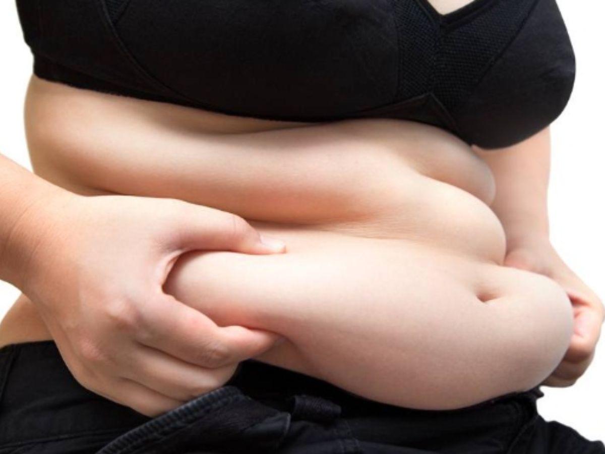 Mỡ bụng là lượng chất béo được tích tụ ở vùng bụng
