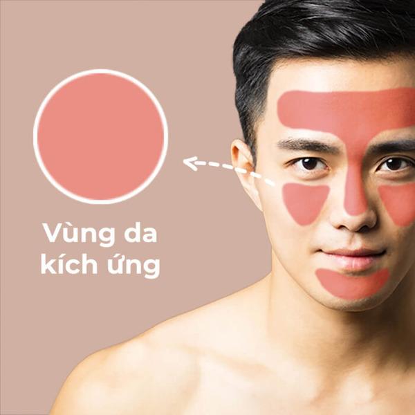 Nếu bạn có làn da nhạy cảm thì nên hạn chế wax lông
