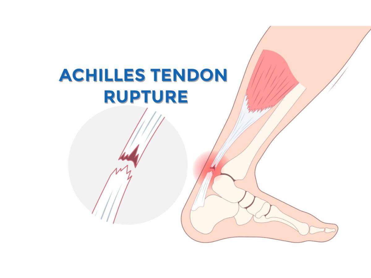 Các bệnh lý tiềm ẩn