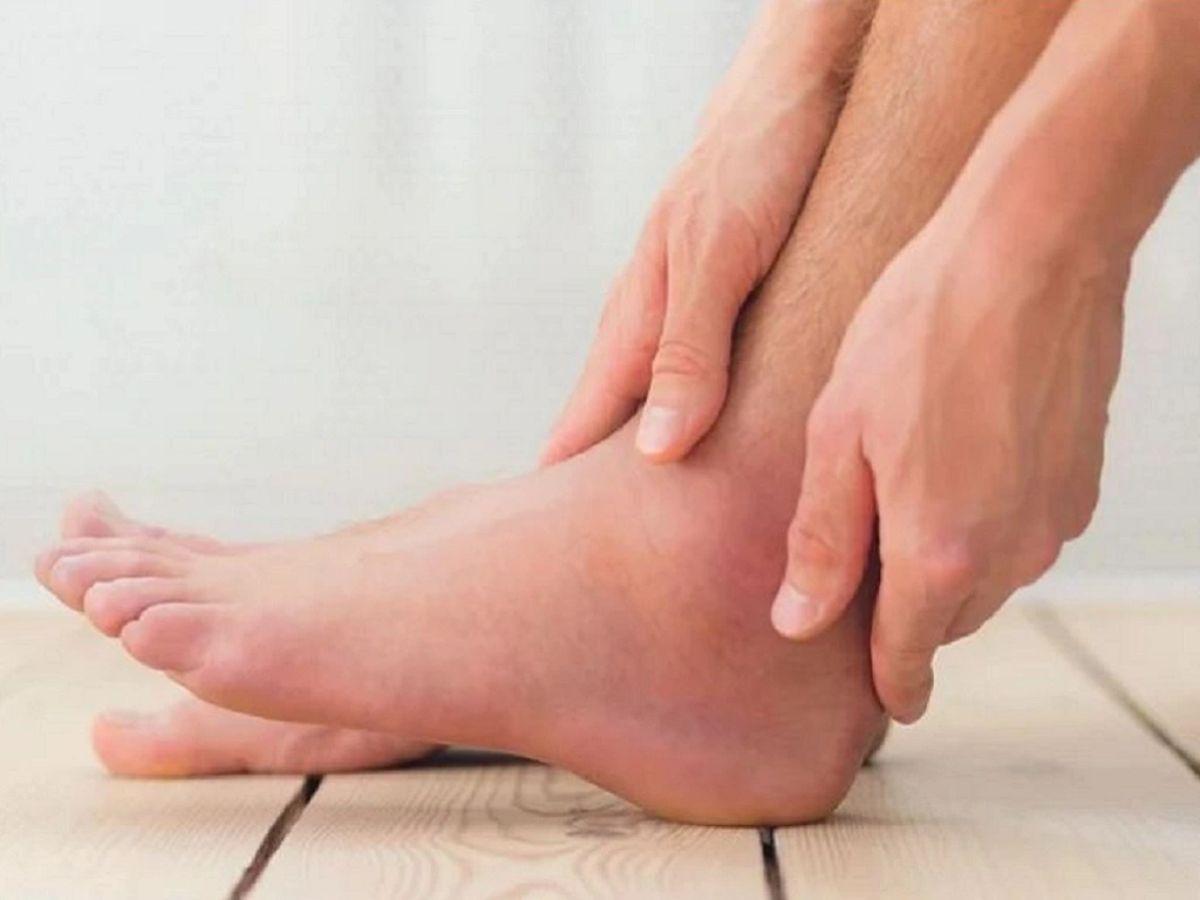 Khi bị bong gân mắt cá chân, bạn sẽ cảm thấy cơn đau dữ dội ngay lập tức ở vùng mắt cá chân