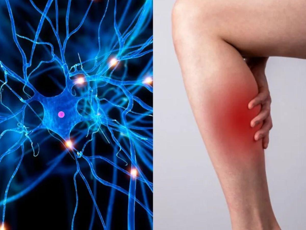 Các bó cơ bị chèn ép làm cho bắp chân bị chuột rút