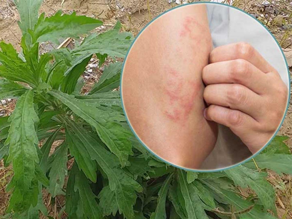 Tác dụng phụ có thể gặp và cách xử lý