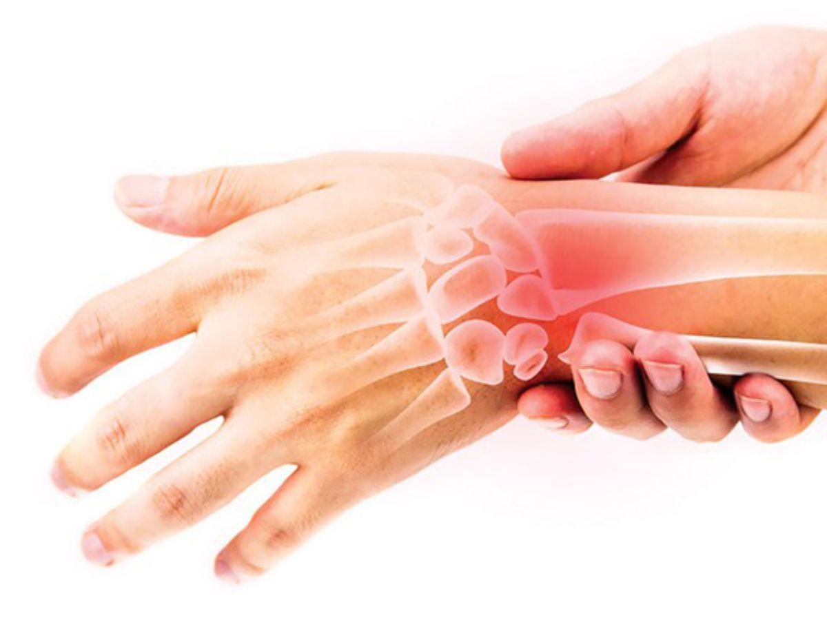 Biến dạng khớp nếu không được chữa trị kịp thời có thể trở thành vĩnh viễn