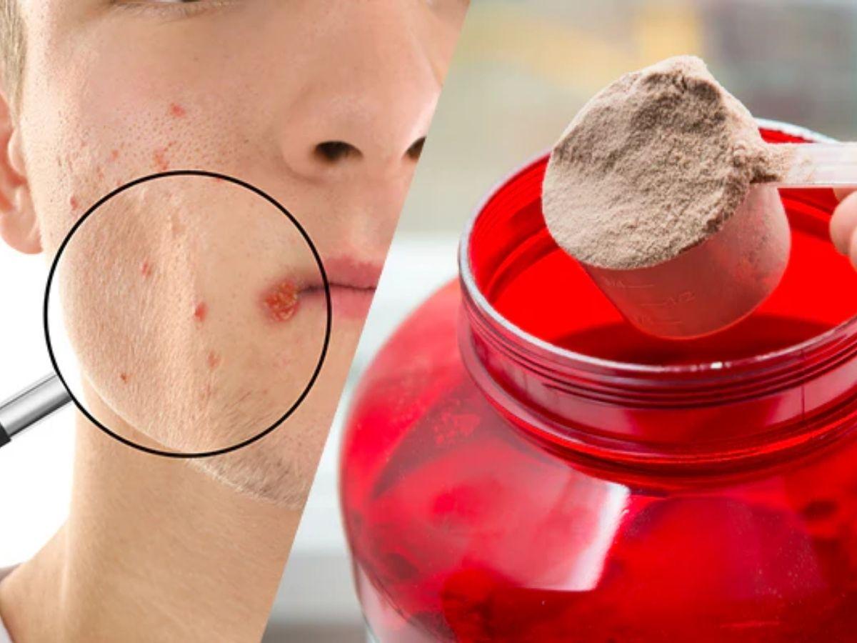 BCAA và tác dụng phụ với da