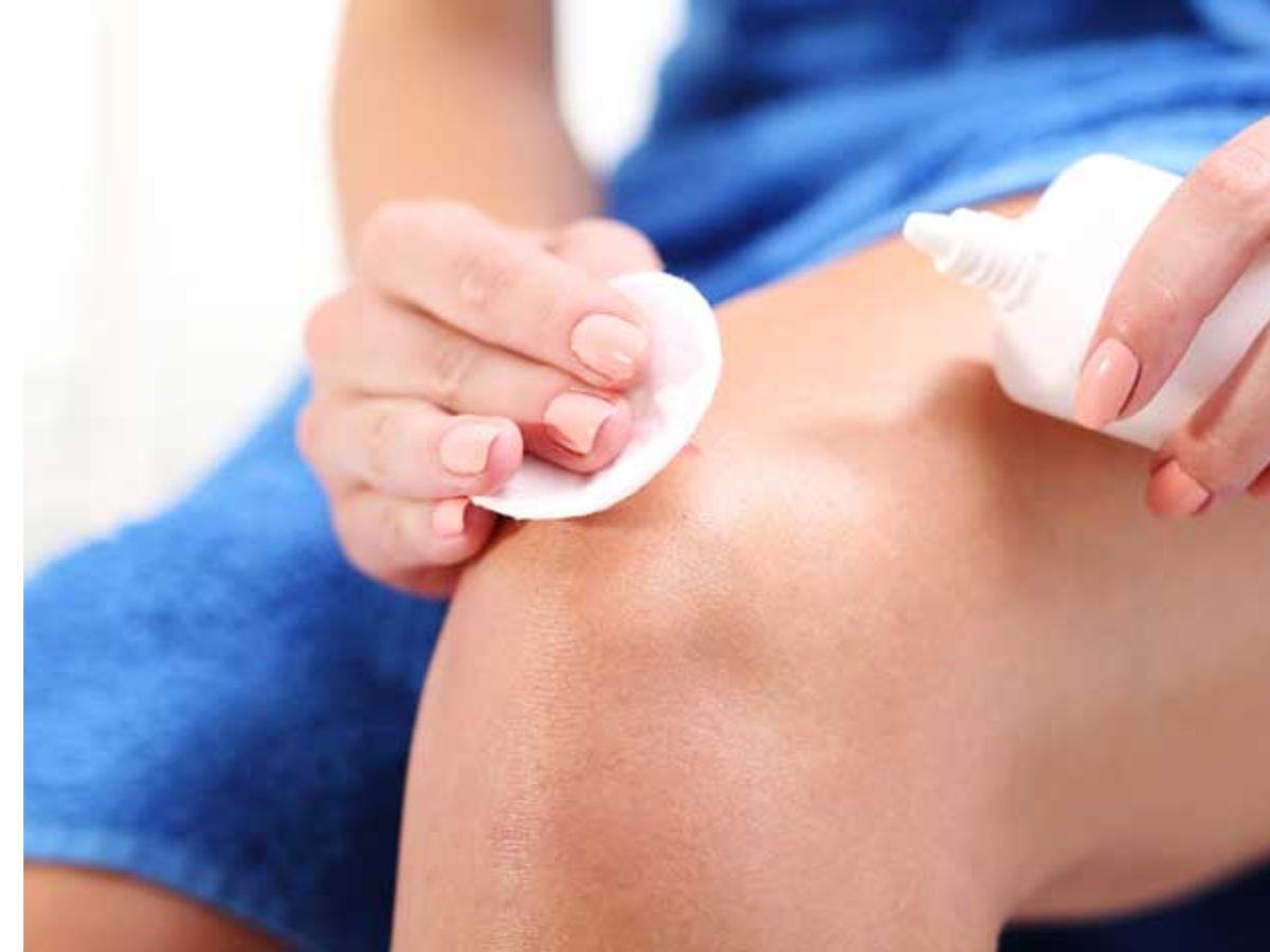 vệ dinh vùng da khi bị chafing