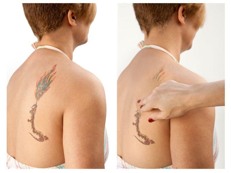 Giải pháp tạm thời giấu hình xăm