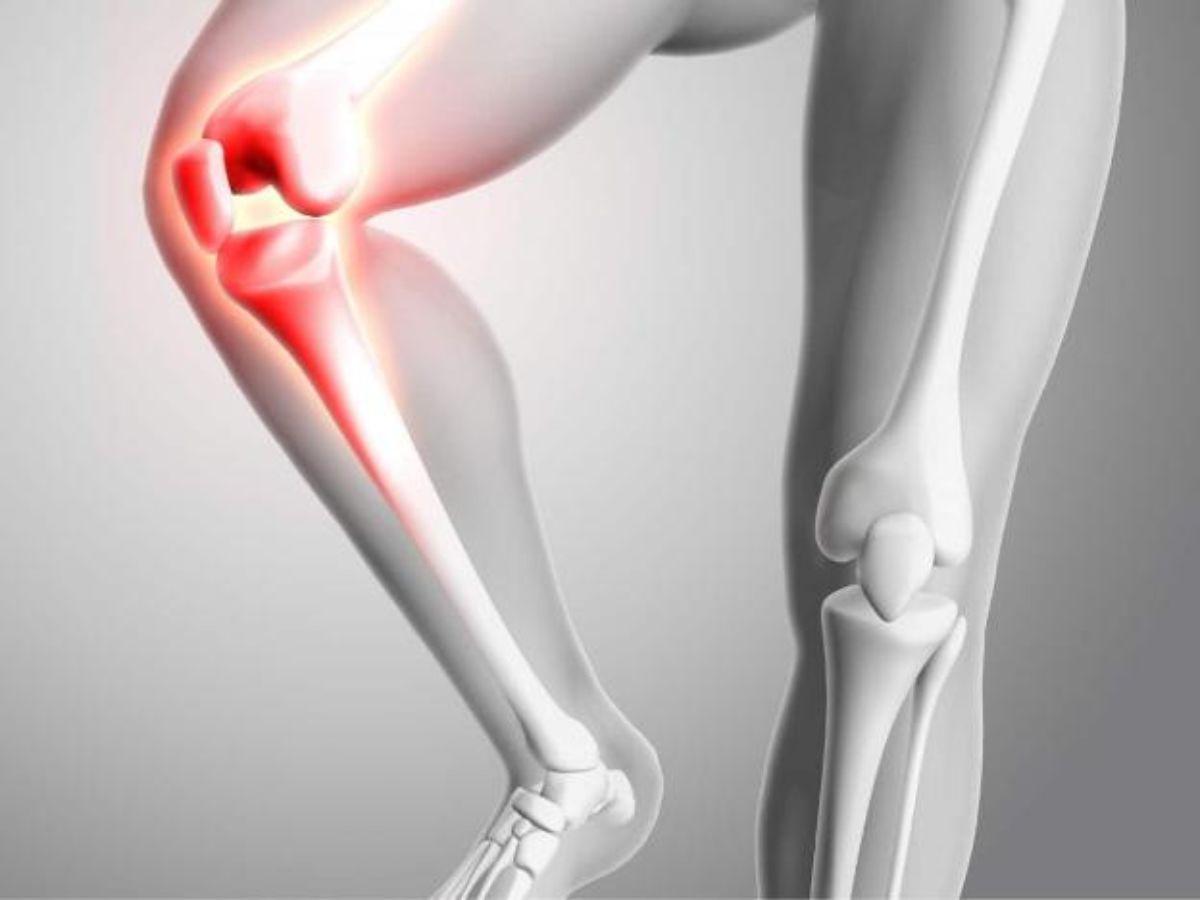 Chạy bộ hỗ trợ sức khỏe xương khớp, đặc biệt ở người lớn tuổi