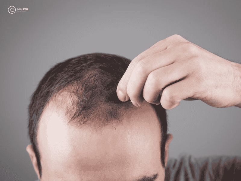 huong-dan-moc-toc-nhanh-cho-nam