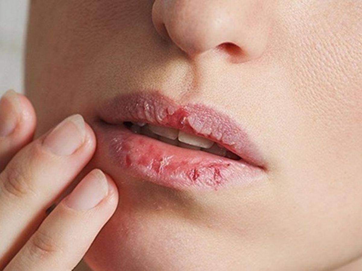 Những điều nên làm và không nên đụng vào khi tẩy tế bào chết môi
