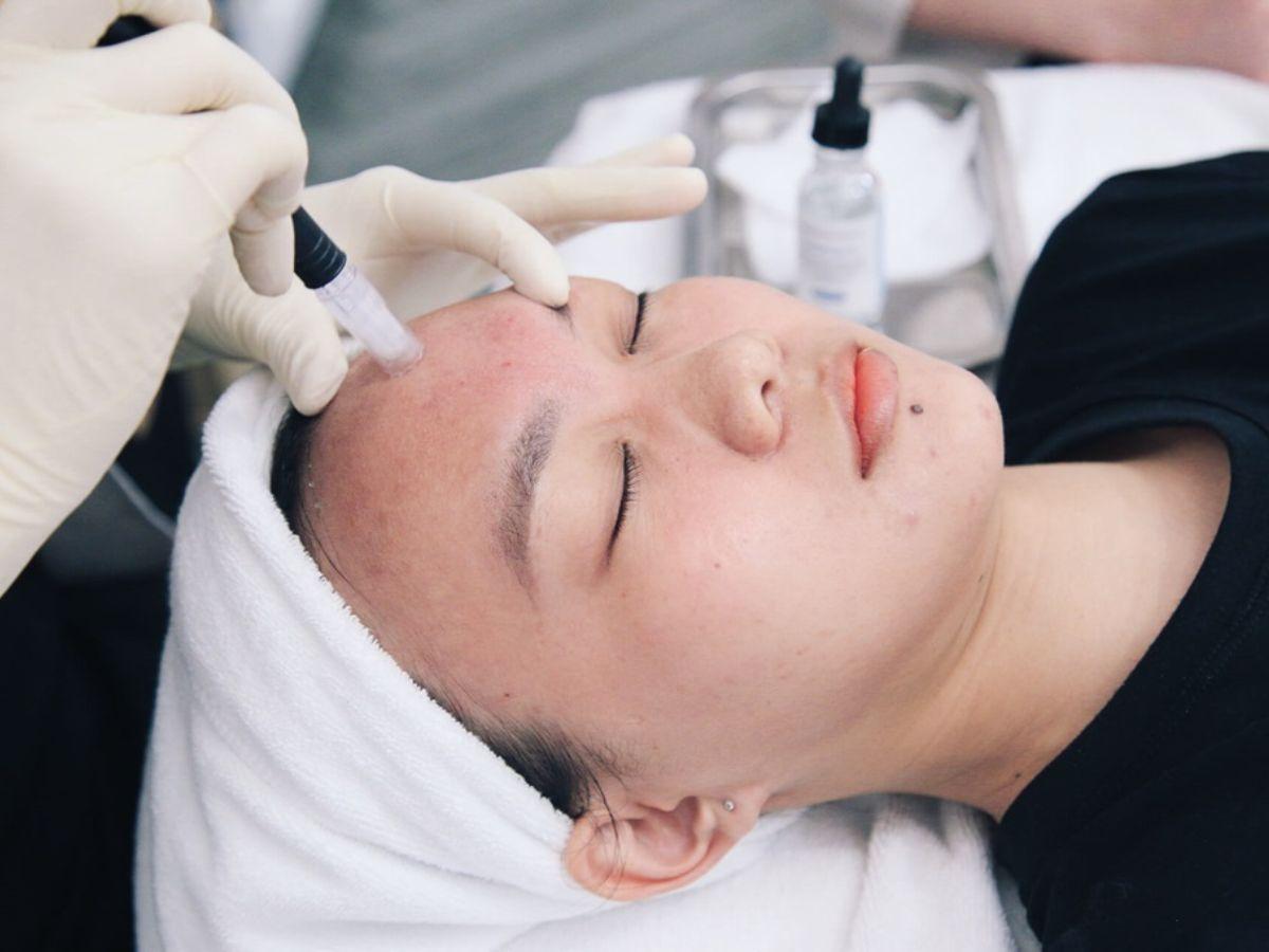 Giải đáp thắc mắc thường gặp về chăm sóc da sau khi nặn mụn