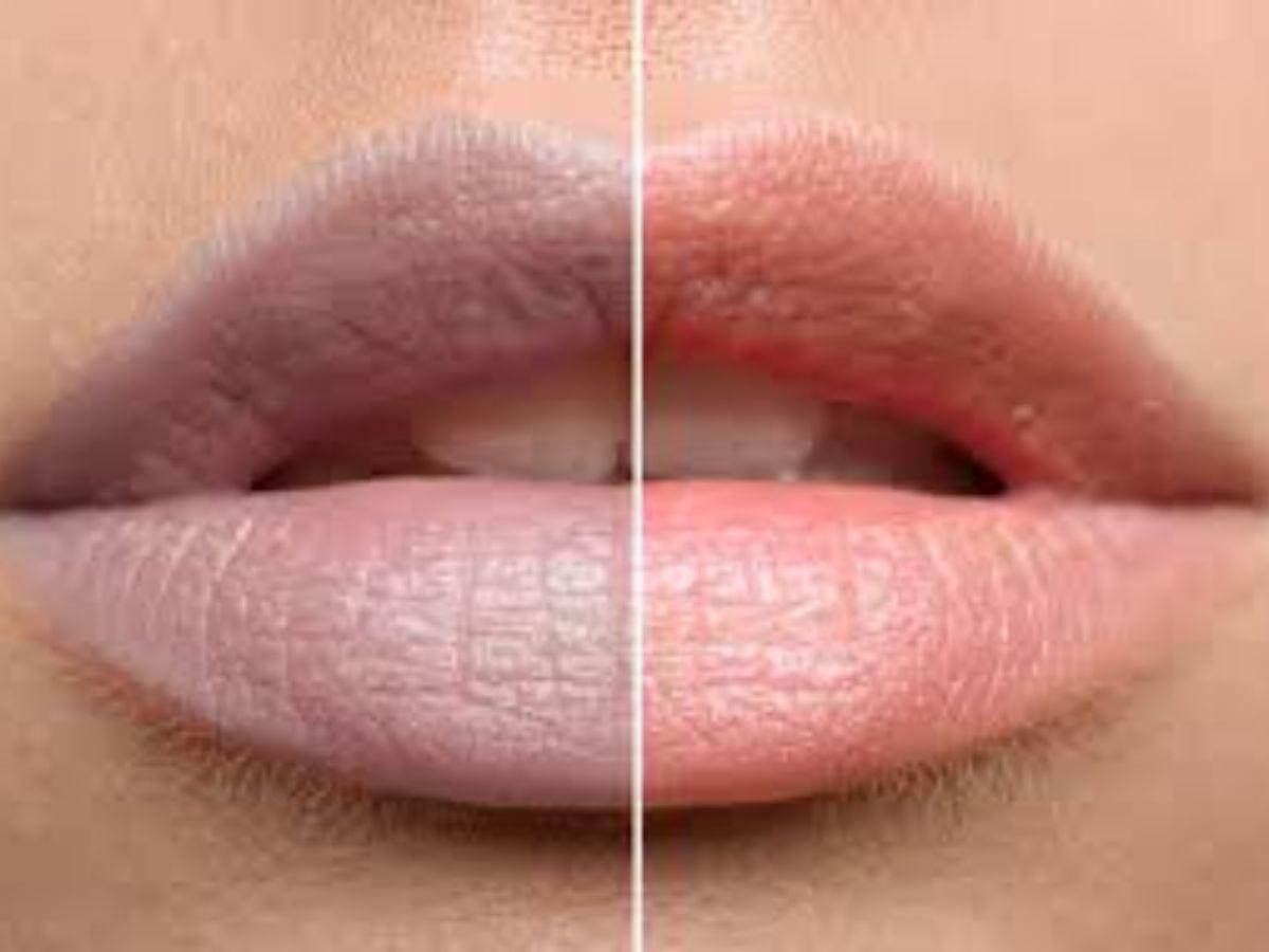 Chọn nhầm son dưỡng kém chất lượng chứa thành phần đáng ngờ