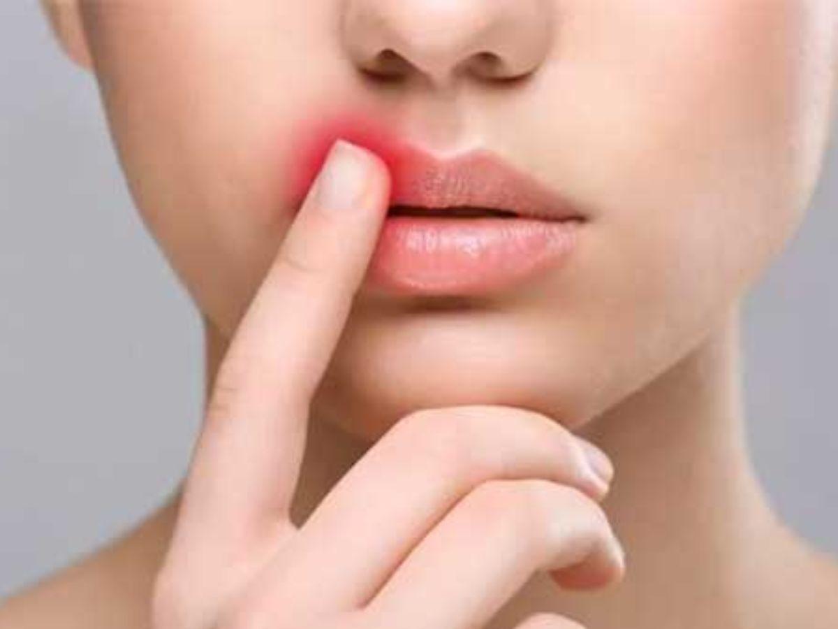 Các thành phần nên tìm kiếm