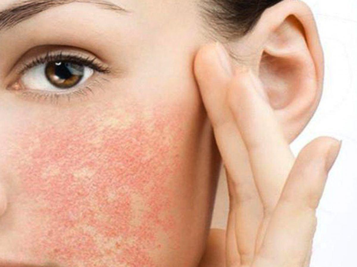 Dấu hiệu da tổn thương vì trang điểm sai