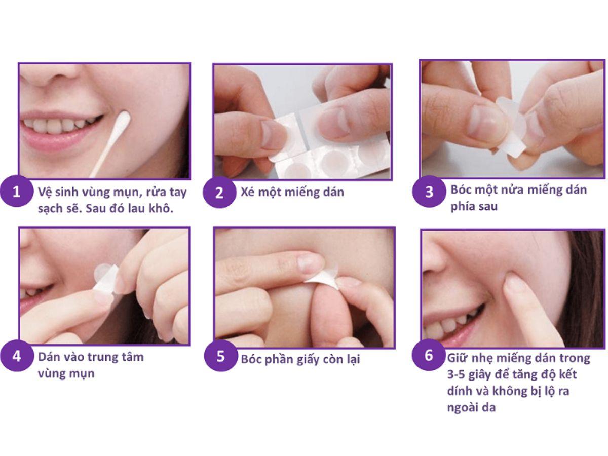 Cách dùng miếng dán mụn đúng chuẩn