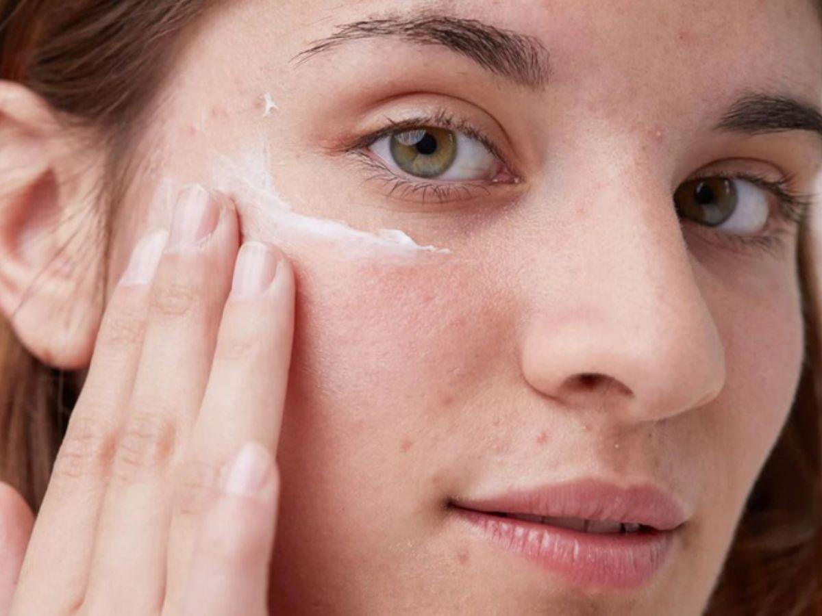 Kem chống nắng nâng tone nhẹ có khiến vùng mụn bớt đỏ