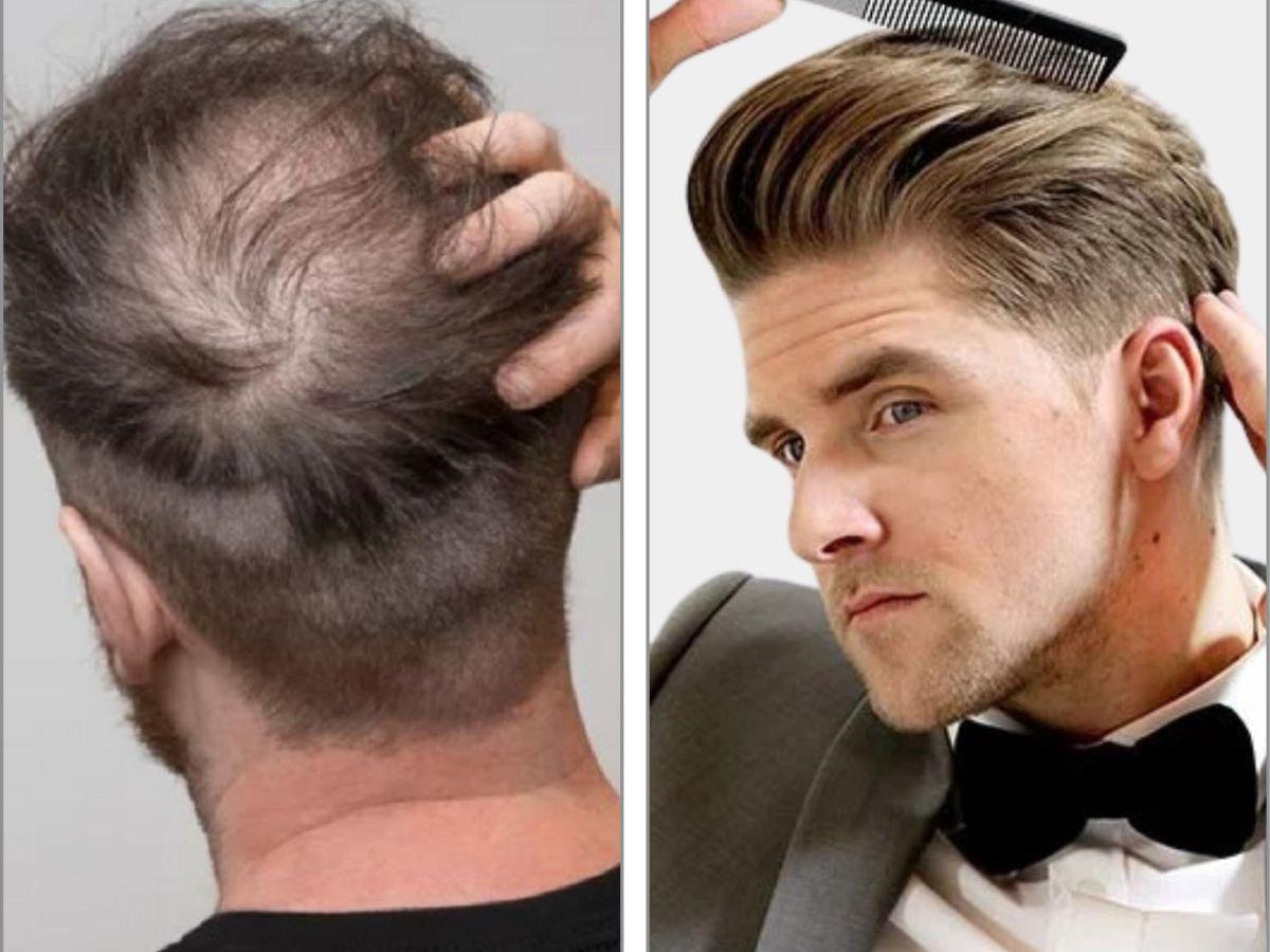 Sự đối lập giữa người đàn ông stress và người đàn ông thư thái
