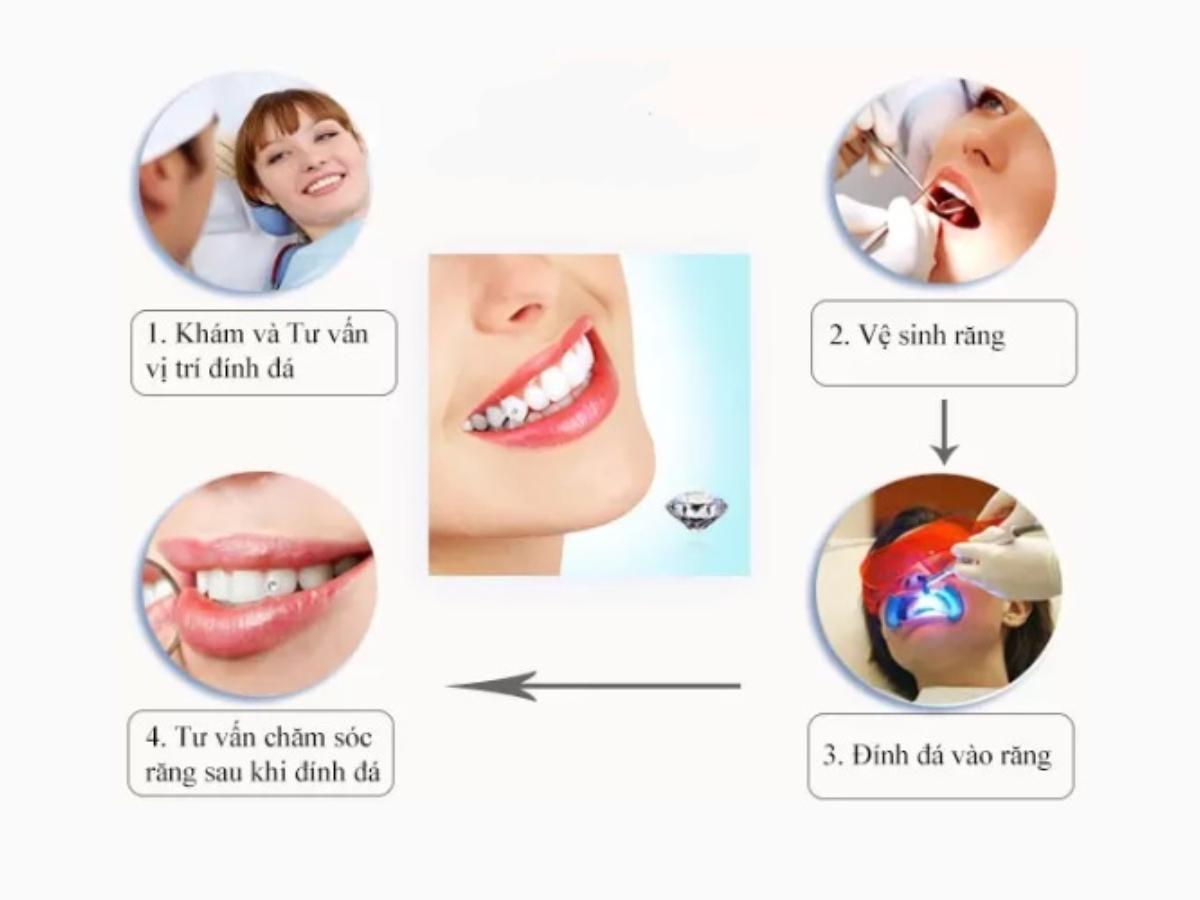 Quy trình tư vấn cần chuyên nghiệp và rõ ràng 