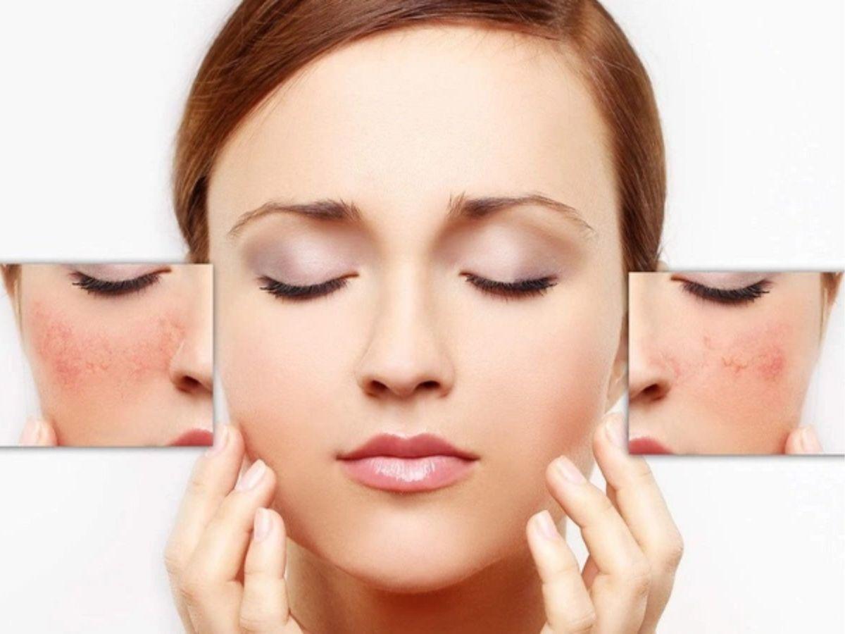 Giảm nguy cơ kích ứng mỹ phẩm