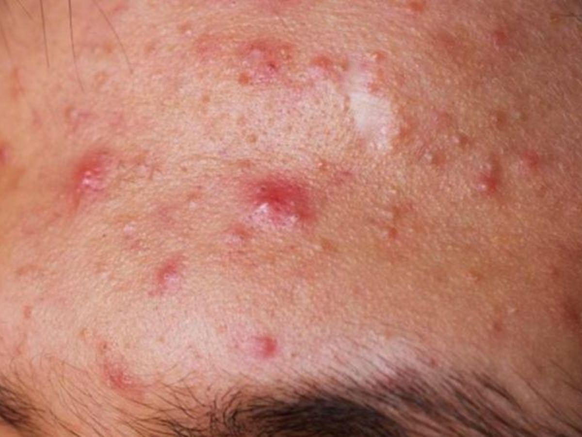 Lựa chọn kỹ để tr&aacute;nh k&iacute;ch ứng