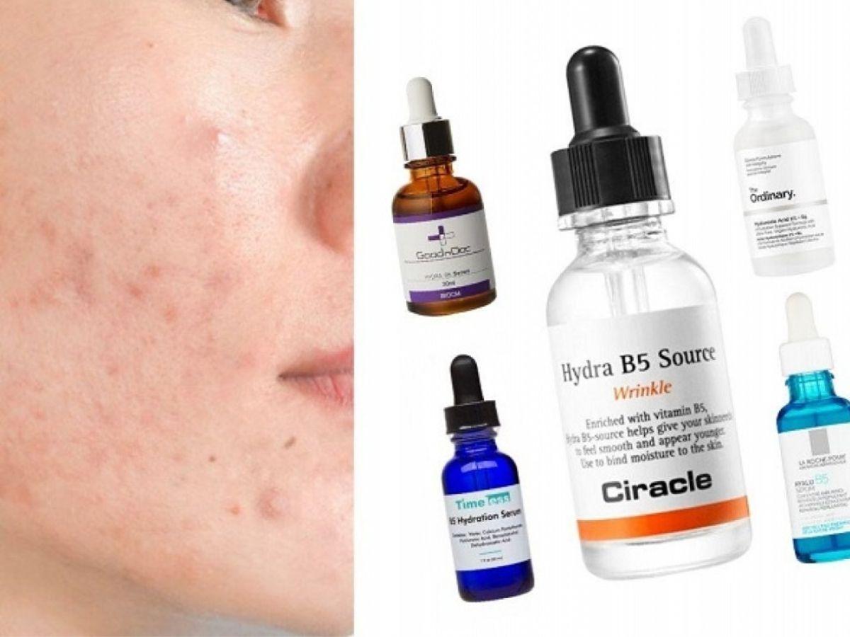 Serum B5 giúp kiểm soát quá trình lành vết thương, giảm thâm sạm và sẹo mụn