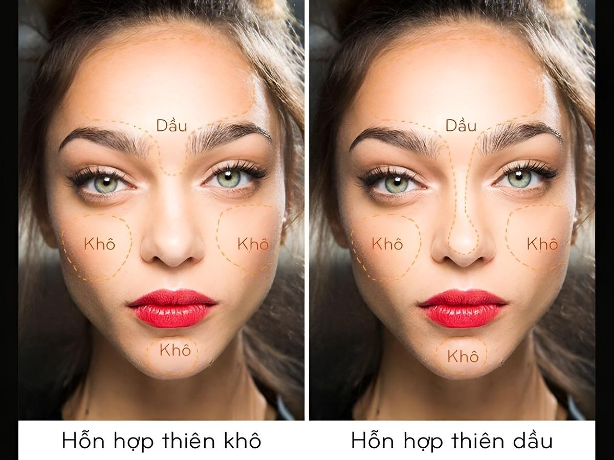 Phân biệt da hỗn hợp thiên khô và da hỗn hợp thiên dầu