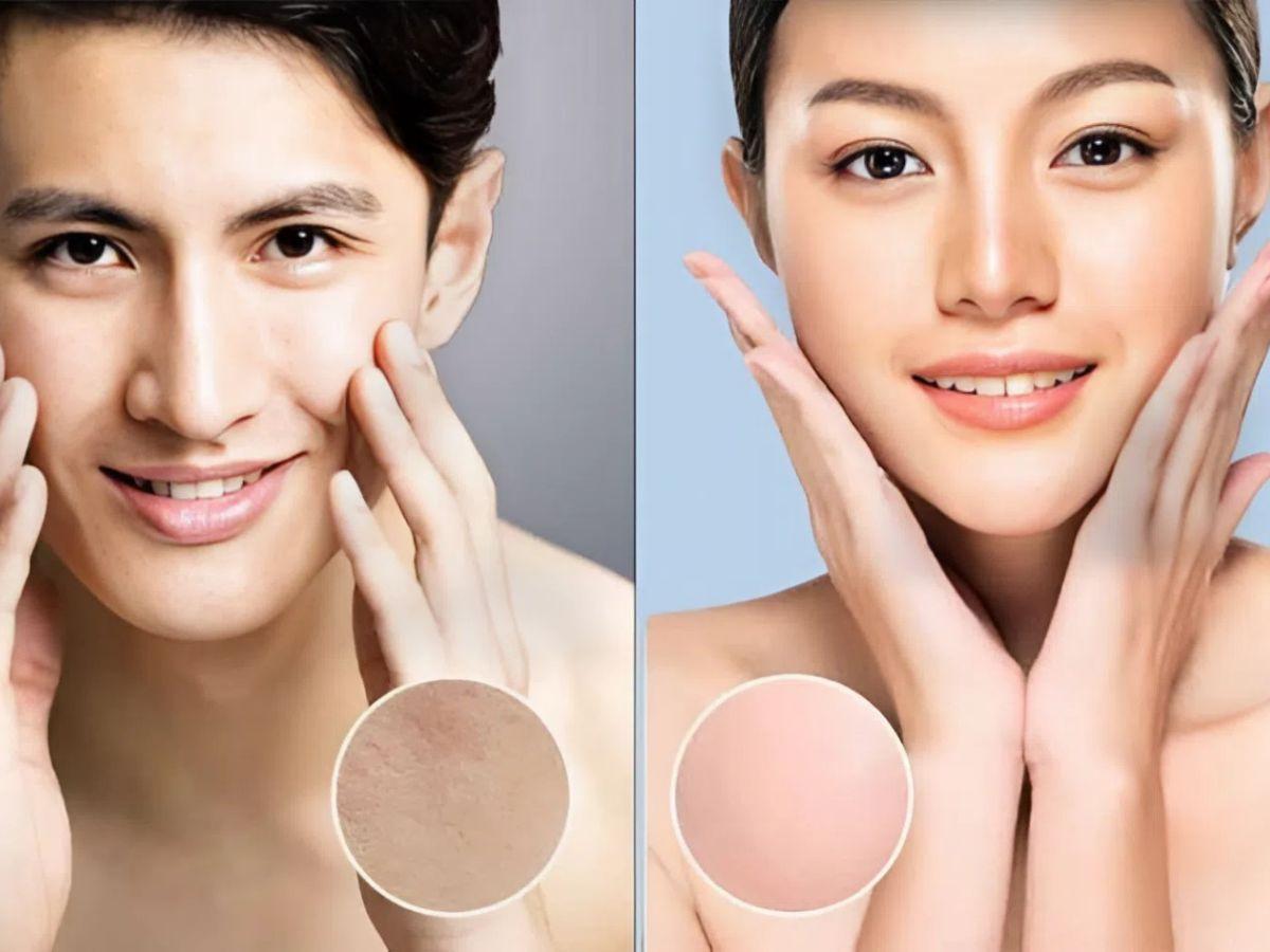 Làn da của nam giới có cấu trúc dày và tuyến dầu hoạt động mạnh mẽ hơn so với nữ giới