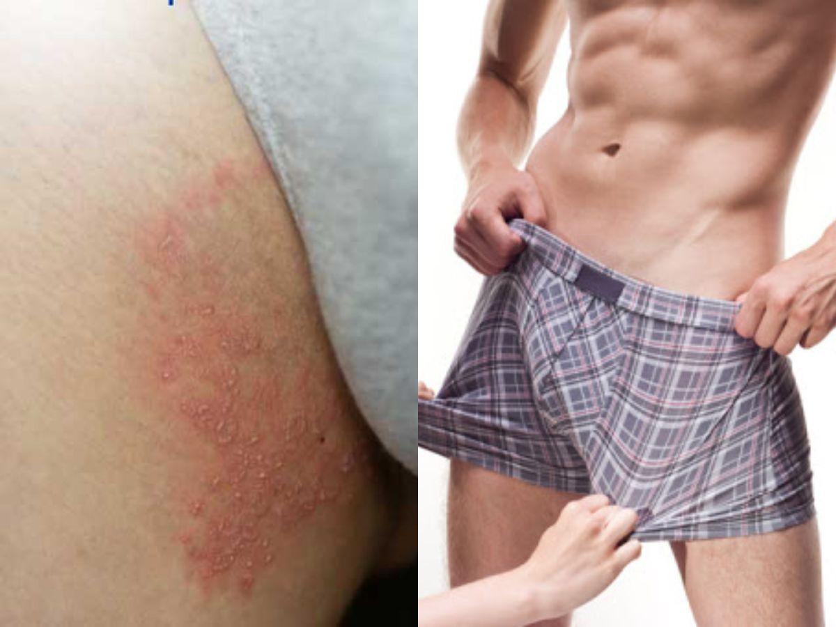 Mặc quần lót quá cũ khiến vi khuẩn dễ sinh sôi