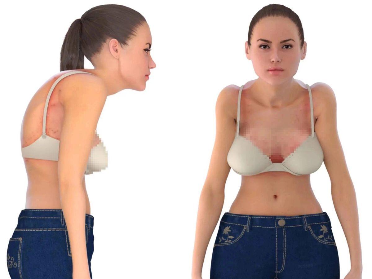Tư thế xấu không chỉ gây khó chịu mà còn làm giảm phong thái và sự tự tin khi di chuyển hay giao tiếp