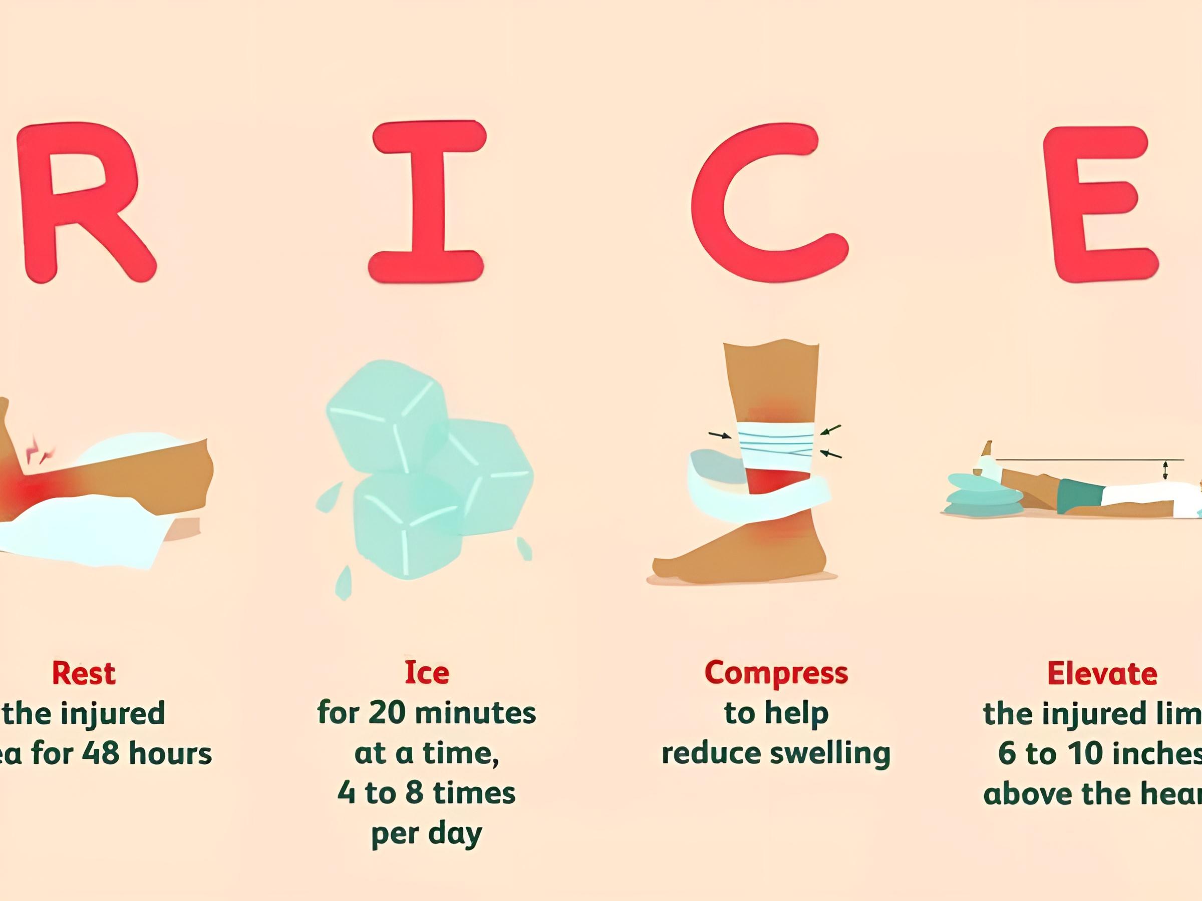 Nguyên tắc R.I.C.E rất hiệu quả giúp giảm sưng và đau khi chạy bộ