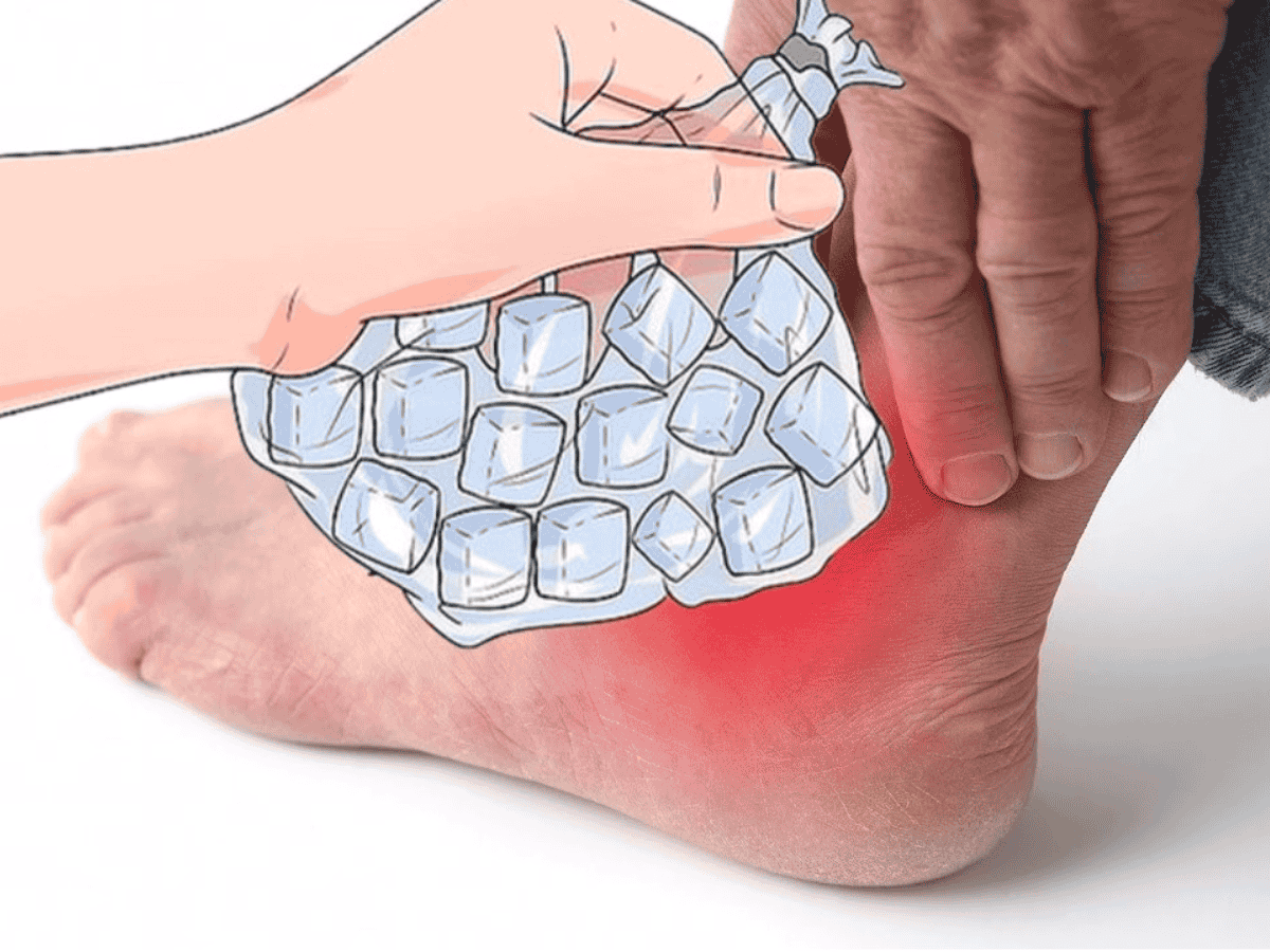 Các biện pháp hỗ trợ phục hồi vết phồng tại nhà