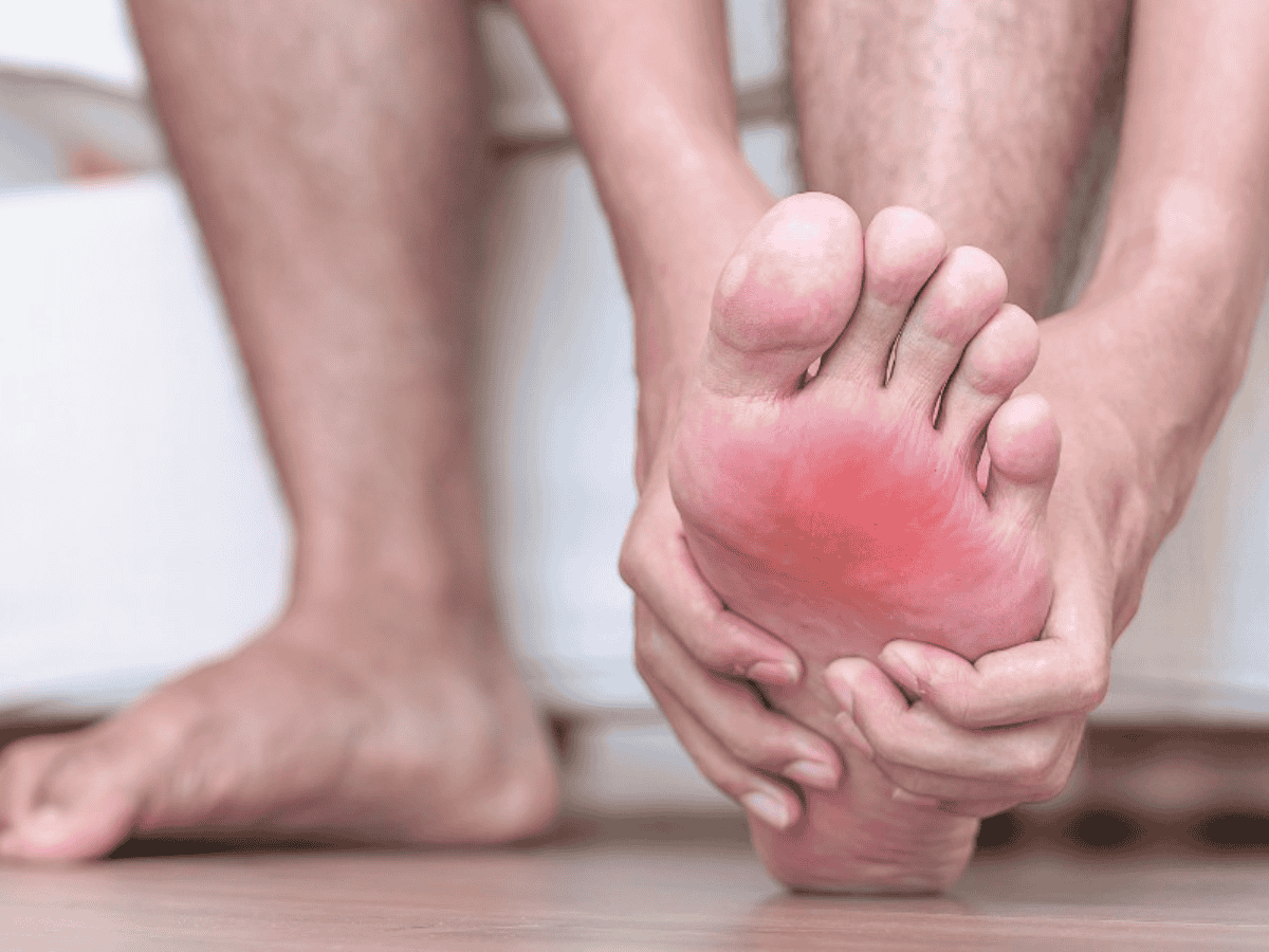 Không nên cố gắng làm vỡ lớp da bị phồng