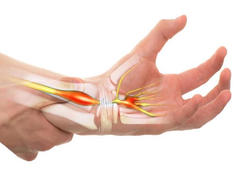 Cơ cẳng tay thường hay bị nhức