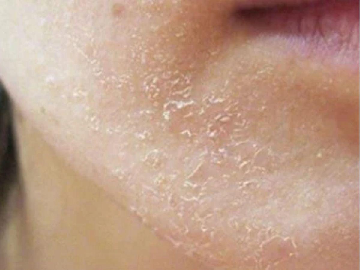  Lỗi Makeup Lớp Nền Bị Mốc