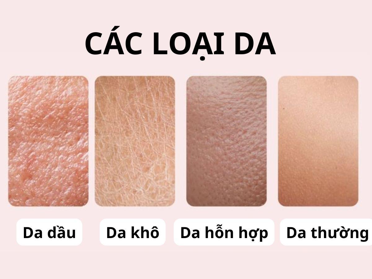 Các loại da phổ biến của nam giới