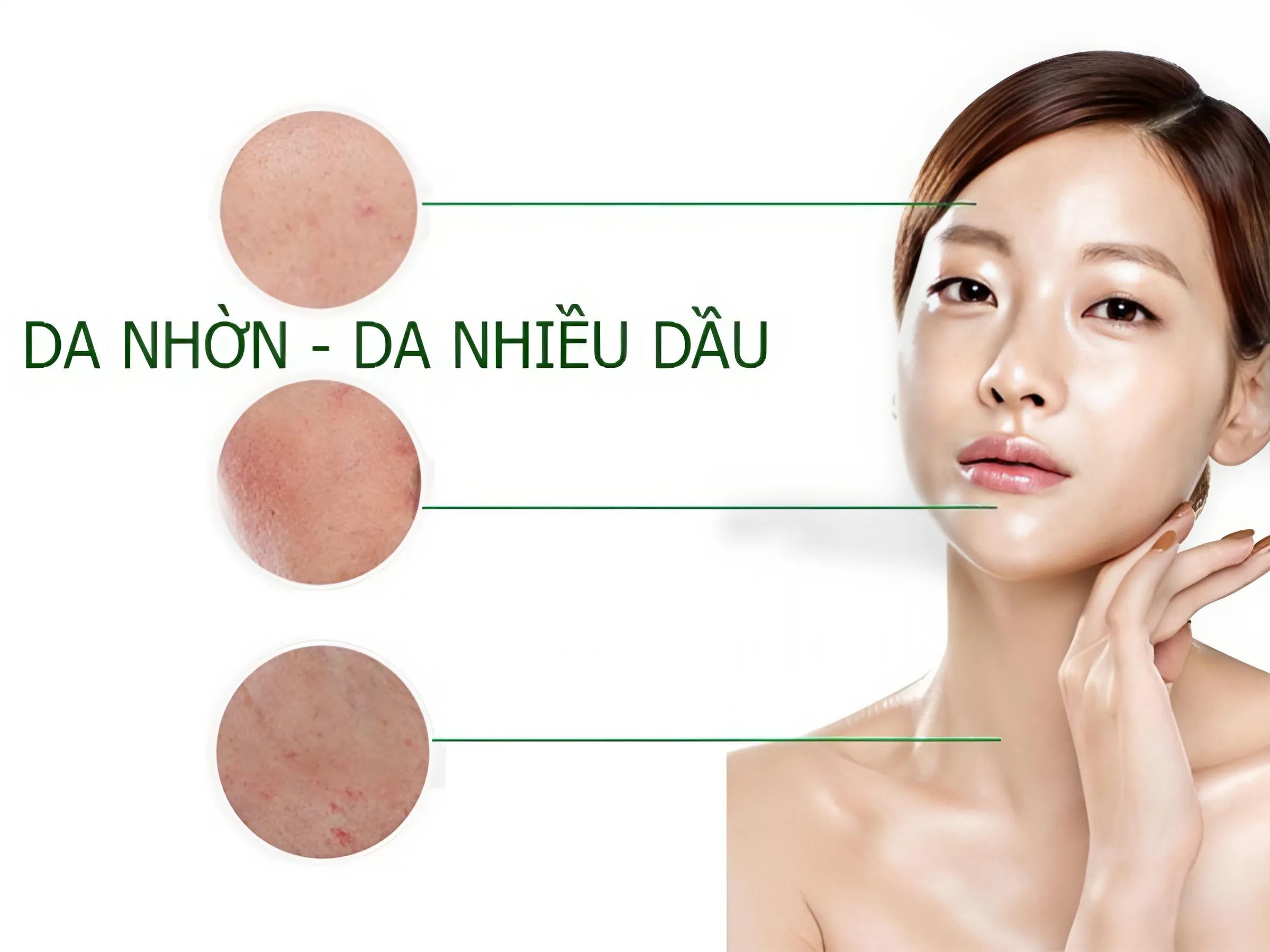 Team da dầu, Lỗ chân lông to 