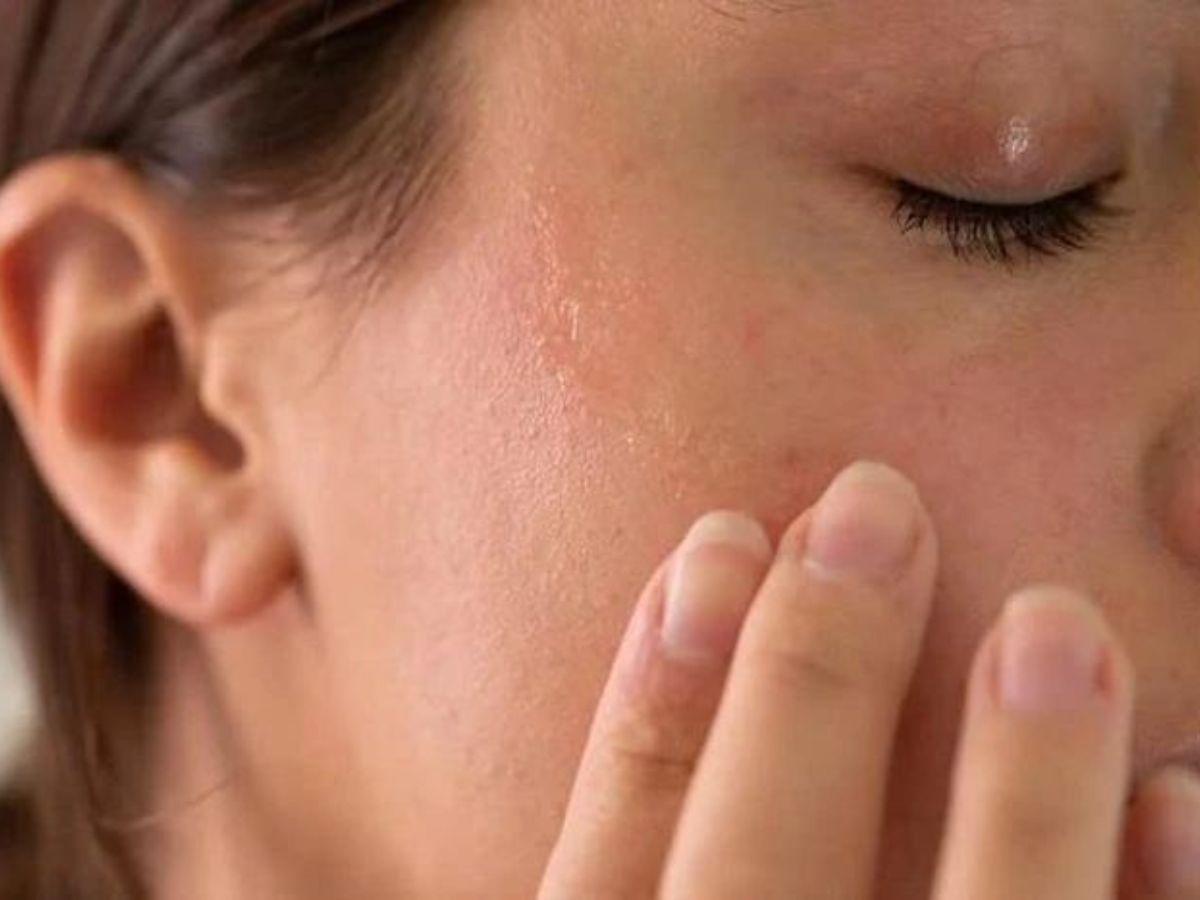 Xịt khoáng làm dịu da kích ứng